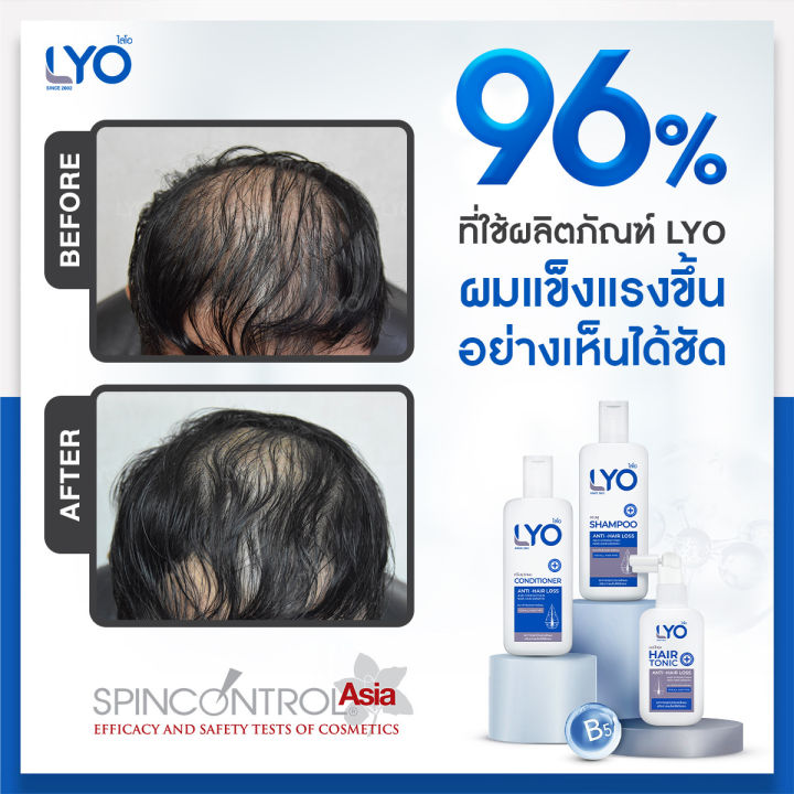 ซื้อ-2-แถม-8-ไลโอ-แฮร์โทนิค-2ชิ้น-แชมพู-4ชิ้น-ครีมนวดผม-4ชิ้น-เซต-บำรุงผม-by-หนุ่มกรรชัย