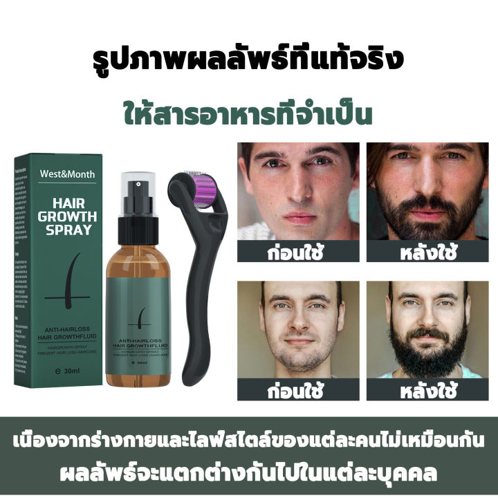 แท้-west-amp-month-beard-growth-spray30ml-ปลูกหนวด-ชุดสเปรย์ปลูกเครา-เซรั่มปลูกหนวด-ปลูกผม-ยาปลูกผม-สเปรย์ปลูกหนวดเครา-เซรั่มปลูกเครา-เซรั่มปลูกผมดก-น้ำยาปลูกหนวด-น้ำมันปลูกหนวด-น้ำมันหนวด-น้ำมันปลูกผ