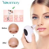 Youmay Blackhead Remover Face Nose Acne Black Dot Pimple Electric Blackhead Vacuum Cleaner Cosmetology Pore Skin Care Tools