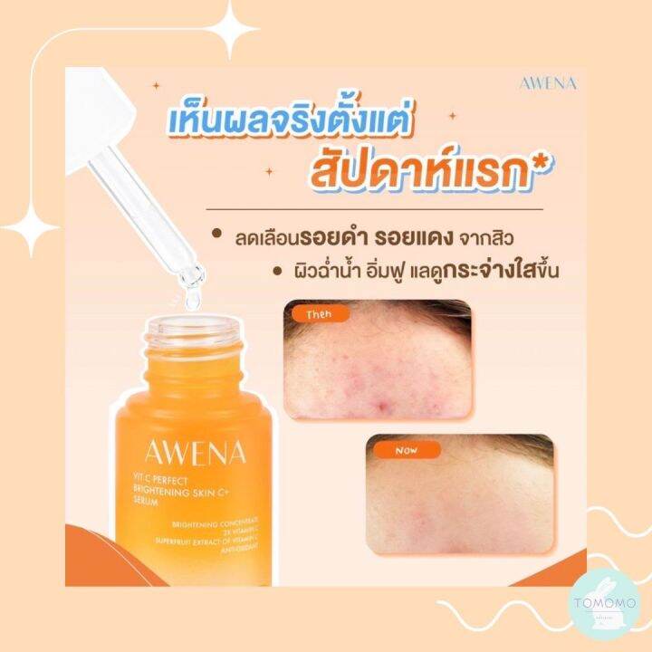 สินค้าพร้อมส่ง-amp-คู่หูเซรั่ม-หน้าใส-ไร้สิว