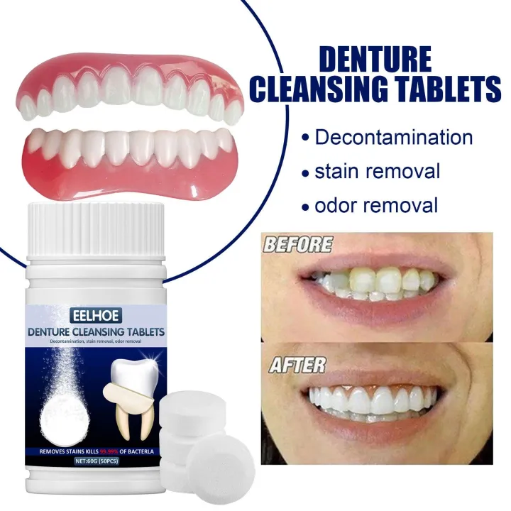 CUTICATE Denture Cleaner Tablet Cleaning Tool 50 Tablet Cleansing