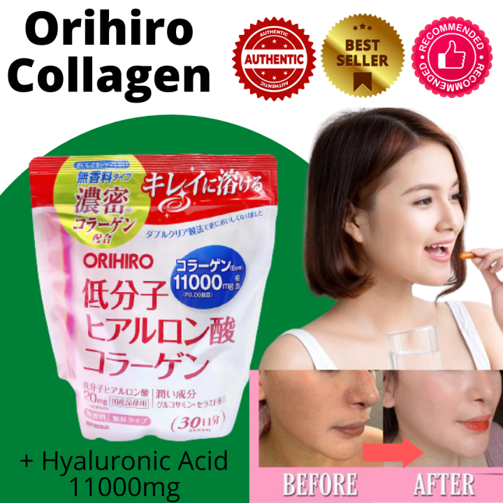 Orihiro Collagen + Hyaluronic Acid 11000mg Lazada PH