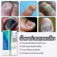 จัดส่งทันที น้ำยารักษาเล็บ 20ml    เล็บเกิดใหม่สวยเหมือนเดิม   เล็บมือ เล็บเท้าใช้ได้หมด  AuQuest น้ำยาทาเล็บ  น้ำยาแก้เล็บเสีย   เซรั่มทาเล็บเสีย   ยาทาเชื้อราที่เล็บ ทำให้เล็บดีขึ้น  ยาทาแก้เชื้อราที่เล็บ  ช่วยลดเชื้อราที่เล็บมือ