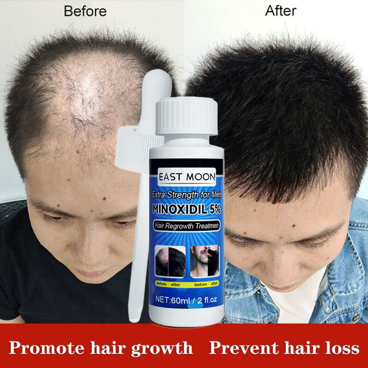 100 Effective Hair Growth Serum 7 Days Hair Grower For Men Original