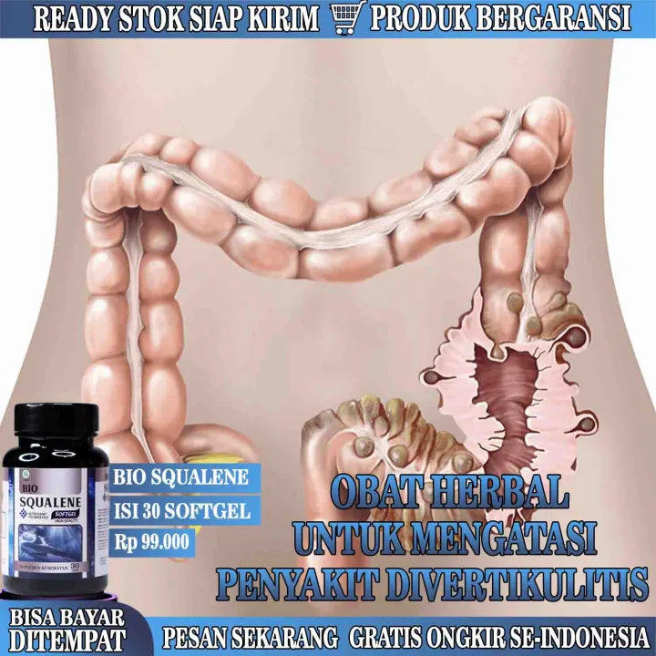obat sakit perut sebelah kiri atas dekat tulang rusuk 13