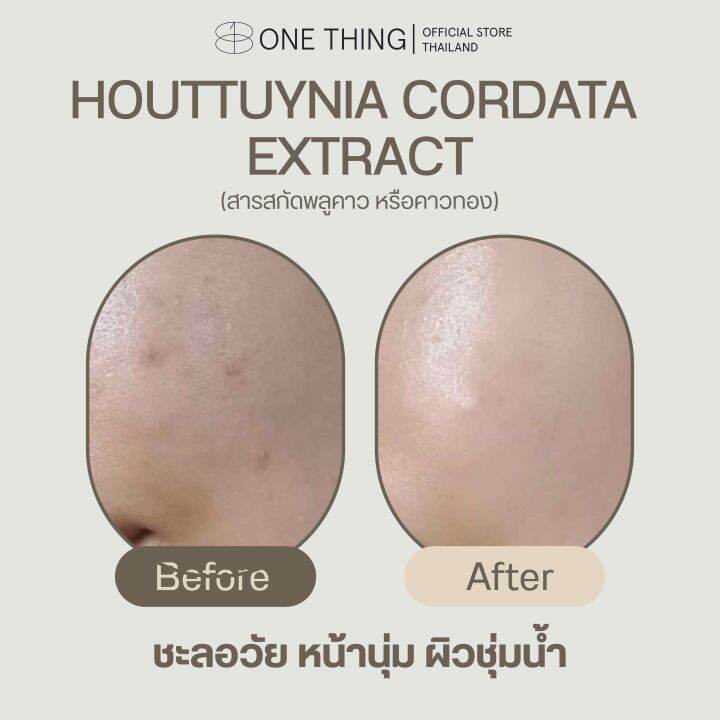 โทนเนอร์-houttuynia-cordata-extract-ซ่อมแซมผิว-ผิวแข็งแรง-exp-2025-สำหรับผิวผสม-แพ้ง่าย