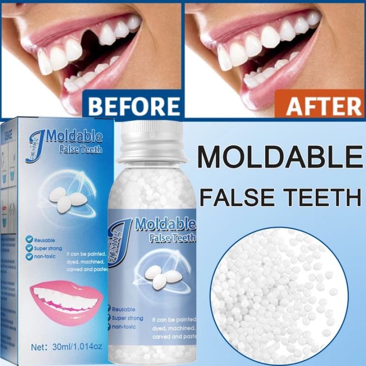 30ML Temporary Tooth Repair Kit Filling Teeth Gaps Moldable False Teeth ...