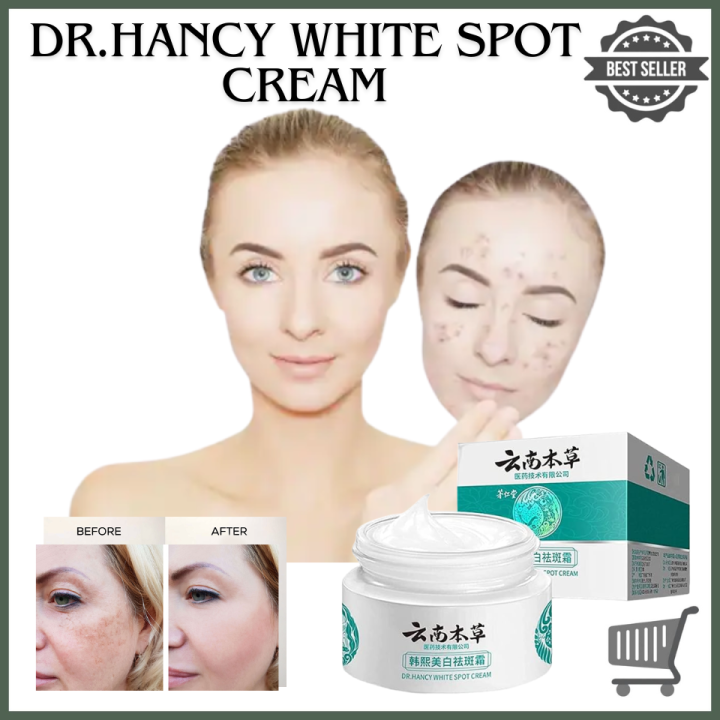 LEGIT DR. HANCY White Spot Cream Japanese Melasma Cream 20g | Lazada PH