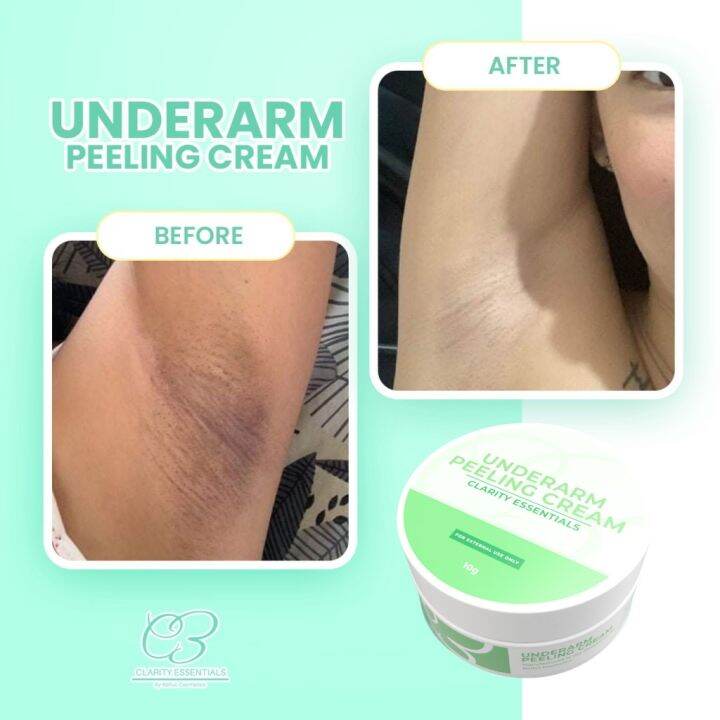 Underarm Peeling Cream Underarm Whitening Cream Clarity Essentials