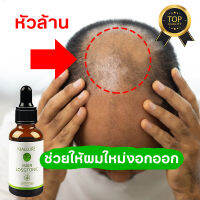 ?แก้ปัญหาหัวล้าน?ปลูกผมหนา ช่วยลดผมร่วง ป้องกันผมร่วง(30ml เซรั่มปลูกผมดก น้ำยาปลูกผม เซรั่มปลูกผม น้ำยาเร่งผมยาว เชรั่มปลูกผม สเป