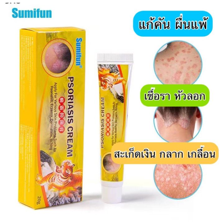 พร้อมส่งส่งฟรี-ใช้ได้ทั้งตัว-สะเก็ดเงิน-กลาก-ครีมลดอาการคัน-ยาทาแก้คัน-ผิวหนัง-ครีมทาแก้เชื้อรา-บำรุงผิว-20-กรัม