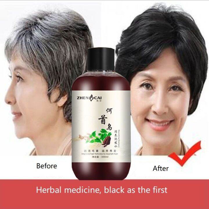 Zhen CAI -black Color hair shampoo Chinese herbal white hair & grey hair Treatment shampoo black hair cover white hair to prevent loss hair shampoo 300ml | Lazada Zhen CAI -black Color hair shampoo Chinese herbal white hair & grey hair Treatment shampoo black hair cover white hair to prevent loss hair shampoo 300ml | Lazada
