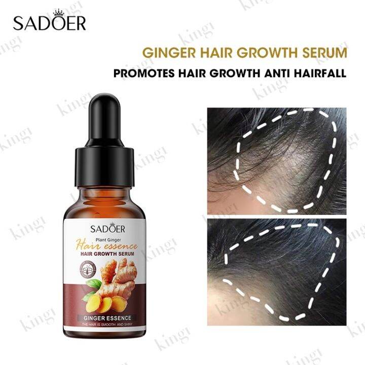 SADOER Ginger Hair Growth Serum Anti Hairfall Hair Loss Treatment Hair