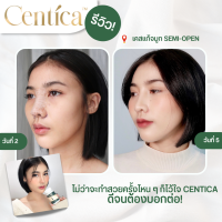 Centica อาหารเสริมเพื่อการฟื้นฟูหลังศัลยกรรม ลดบวมช้ำหลังศัลยกรรม ช่วยสมานแผล ของแท้ 100%