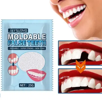 Teeth Glue Tooth Repair Kit Moldable Tooth Broken Teeth Gaps Repair Tw