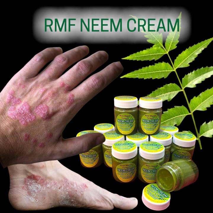 RMF NEEM CREAM for ECZEMA Lazada PH