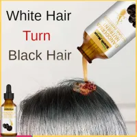 White Hair Treatment - Best Price in Singapore - Aug 2022 