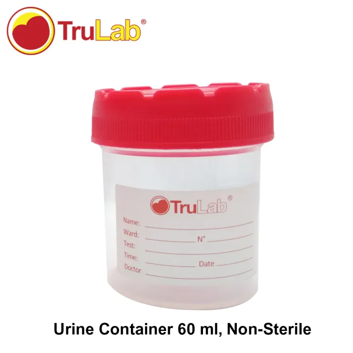 Urine Container, Non-Sterile, 60 ml, 100 pcs. | Lazada PH