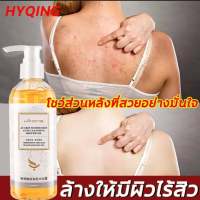 เจลอาบน้ำ shower gel 260ml ครีมเจลลดสิว ขจัดไรและสิว บอกลาผิวหยาบกร้าน อ่อนโยนไม่ระคายเคือง