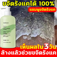 MKN แชมพูขจัดรังแค ล้างแล้วช่วยขจัดรังแค ยาสระผมเชื้อรา 500ml กำจัดเกื้อน ยาสระผมรังแค กำจัดไร กำจัดรังแค ควบคุมน้ำมัน แชมพูแก้ผมร่วง ยาสระผมแก้คัน