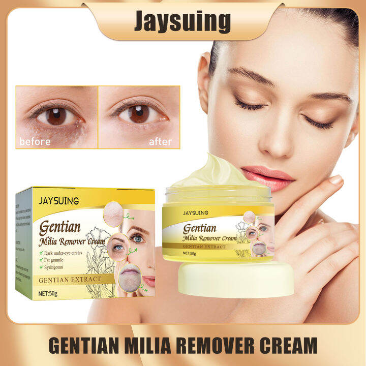 Jaysuing Gentian Milia Remover Cream Effective Removes Fat Granules
