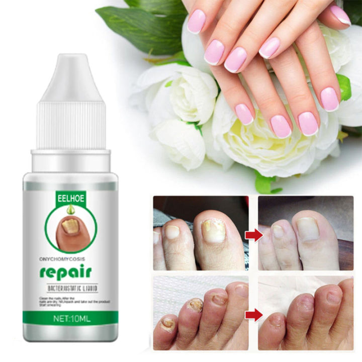 MAFFICK Eelhoe Onychomycosis Repair Liquid Nail Treatment Liquid