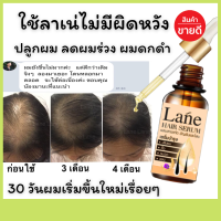 Lane เซรั่มปลูกผม ยาปลูกผม น้ำยาปลูกผม 30วันผมเริ่มงอก เรื่อยๆ(ใช้ 1 เดือน )