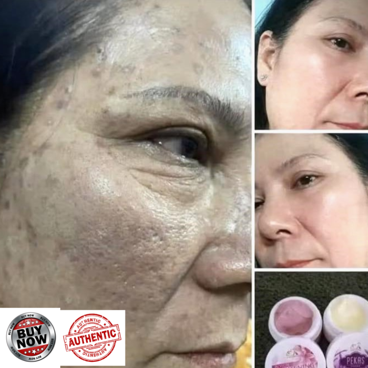 CAPADOSA PEkas Eraser and Botox cream 10g {ALL AUTHENTIC Ingredients