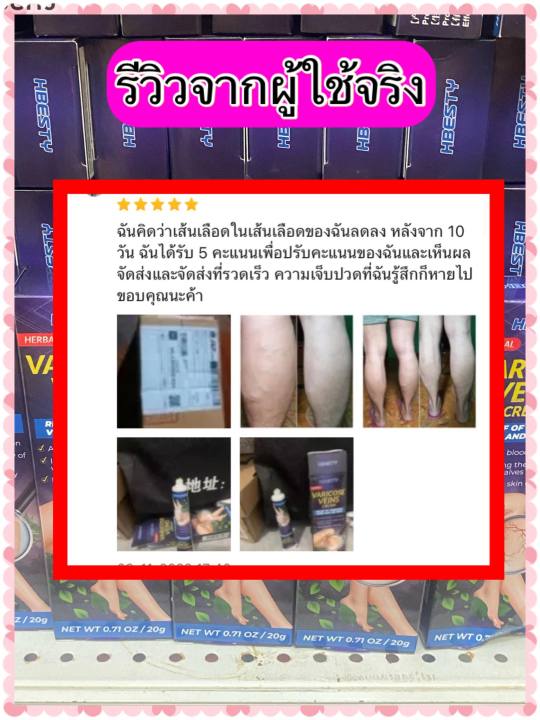 ส่งฟรี-hbesty-ครีมทาเส้นเลือดขอด-ขาสวย-บอกลาเส้นเลือดขอด-ครีมทาเส้นเลือดขอด-ขนาด-20-กรัม