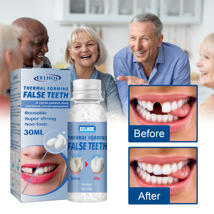 Temporary Tooth Filling Repair Kit False Teeth Solid Glue Dental