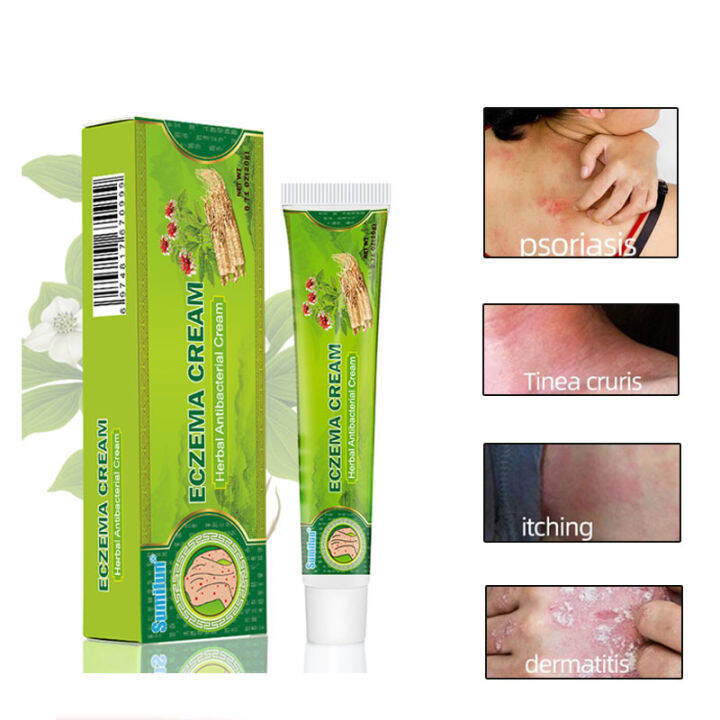 Exzema cream/Herbal Antibacterial Cream/Chinese herbal skin psoriasis ...