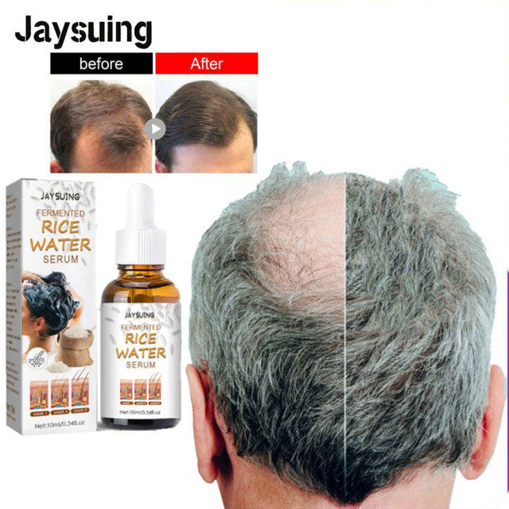 JAYSUING Hair Growth Essence Anti Hair Loss Liquid Promote Thick Fast
