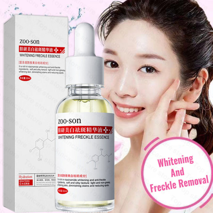 Whitening Freckle Serum 30ml Anti Freckle Essence Melasma And Pekas Remover Serum Freckle Cream