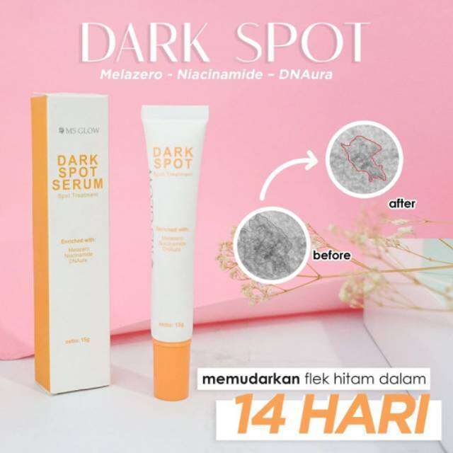 PROMO- MS GLOW SPOT TREATMENT/KRIM BINTIK HITAM/FLEK HITAM/ MS GLOW ...