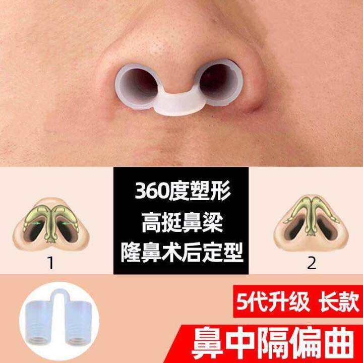 Nasal Septum Deviation Brace Snoring Anti-Snoring Artifact Nasal Splint ...