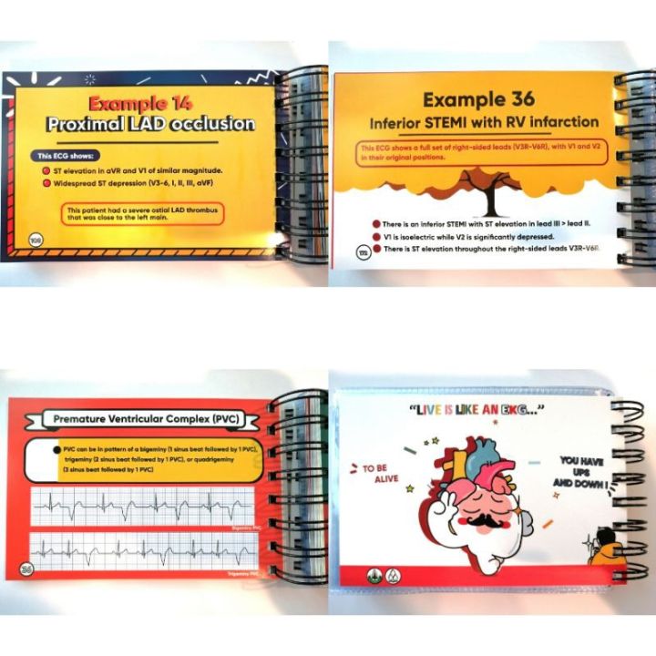 ขายดี-หนังสือ-a-beginners-plearn-with-ekg-electrocardiography-ezy-card-the-review-book-of-practical-ecg-ตำราแพทย์-บริการเก็บเงินปลายทาง