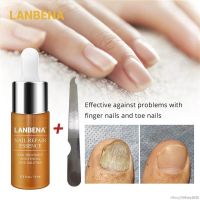 Cozy.【LANBENA】 Nail Repair Essence Oils Serum Nail Treatment Onychomycosis Remove