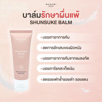 Manami Cloud Baby Balm มานามิ คลาวด์ เบบี้บาล์ม บาล์มรักษาอาการผื่นแพ้ในเด็ก แก้อาการคัน 30 ml.