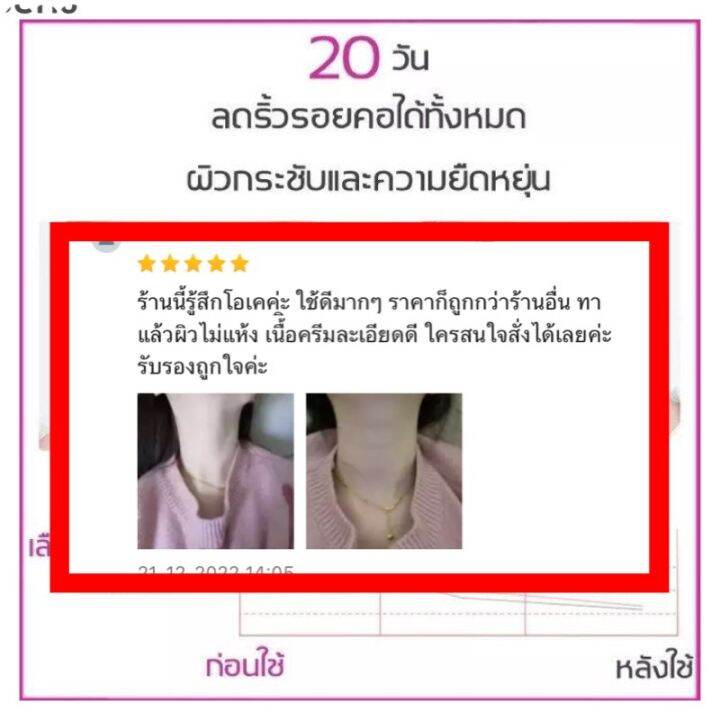 ส่งฟรี-ไวท์เทนนิ่งและกระชับผิวคอ-ครีมทาคอ-ครีมนวดกระชับคอ-ซ่อมแซมรอยเส้นที่คอ-ปรับปรุงริ้วรอย-ปรับรูปร่าง-ยกกระชับบริเวณลำคอ