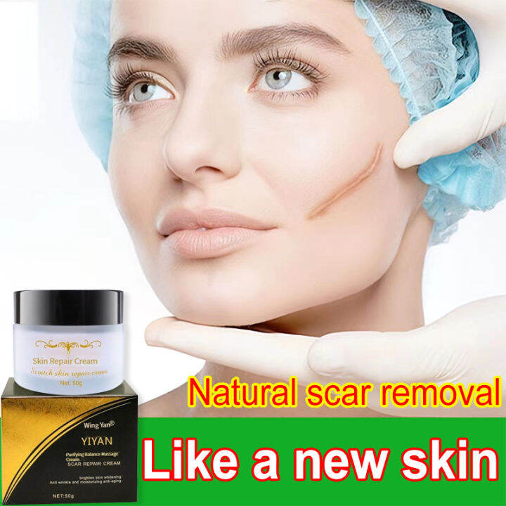 Scars Remover Cream 50g Original Stretch Mark Skin Care Repair Comedone
