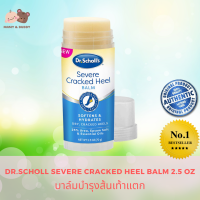 DR.SCHOLL SEVERE CRACKED HEEL BALM SOFTENS &amp; HYDRATES DRY CRACKED HEELS 25% UREA 2.5 oz (70 g) บาล์มทาสนเท้า ลดผิวแตกที่ส้นเท้า บาล์มบำรุงส้นเท้าแตก Mamy and Buddy