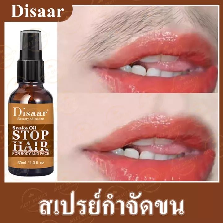 ปัญหาขนตามร่างกาย-สเปรย์กำจัดขน-disaar-ใช้หลังการกำจัดขน-สามารถใช้ได้ทั่วร่างกาย-ขนส่วนเกิน-กำจัดขนรักแร้-สเปรย์กำจัดขน