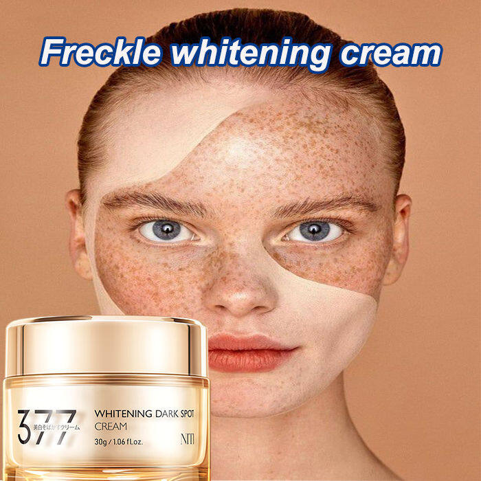 Freckle Whitening Cream Nicotinamide Brightening Moisturizing Cream Anti Aging Lazada