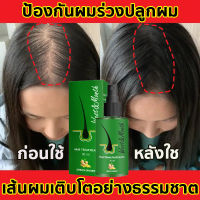 【การส่งมอบกรุงเทพฯ】เซรั่มบำรุงผม สารสกัดจากขิง น้ำยาปลูกผม เซรั่มปลูกผม Ginger Hair Essence ซ่อมแซมผมเสีย เร่งผมยาว ป้องกันผมร่วง