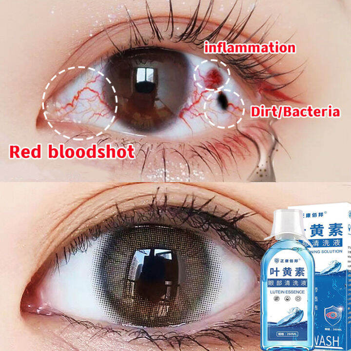 Medical Eye Wash Solution Care Liquid Suitable For Bloodshot Dry Itchy