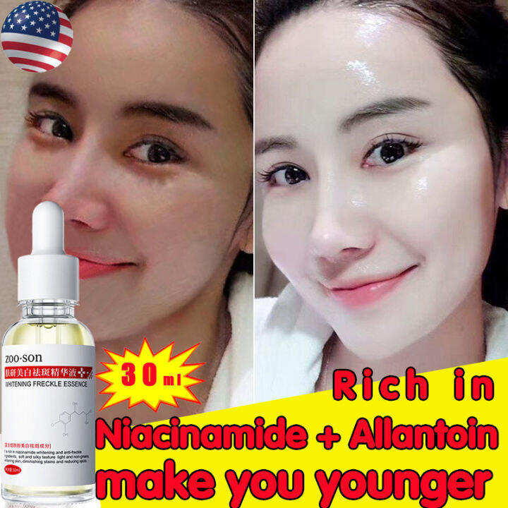 American raw materials ZOO SON Whitening Freckle Essence 30ML Effective ...