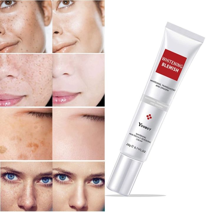 Youbuy Whitening Freckle Cream Remove Dark Spots Anti Freckle Cream Niacinamide Fade