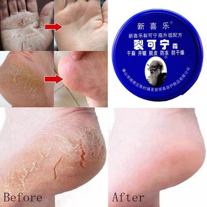 cw-herbal-anti-crack-foot-cream-oil-drying-heel-cracked-repair-removal-dead-skin-hand-feet-care-mask