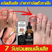 nail fungus medicine เซรั่มบำรุงเล็บ เซรั่มซ่อมแซมเล็บ ไม่ทำร้ายเล็บดี บำรุงพื้นผิวเล็บ ฆ่าเชื้อราที่เล็บ แก้ไขปัญหาเล็บ（เชื้อราเล็บ เชื้อราเล็บมือ ยาแก้เชื้อราเล็บ น้ำมันบำรุงเล็บ ครีมบำรุงเล็บ เชื้อราที่เล็บ ยาเล็บขบ ครีมบำรุงซ่อมแซมเล็บ ）