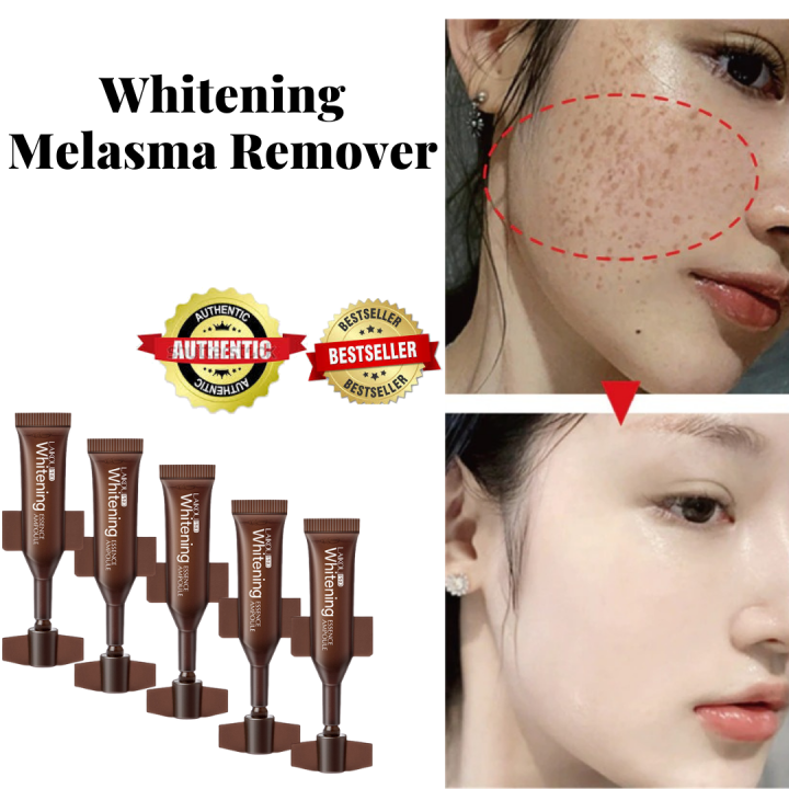 Effective Freckle Whitening Serum Remove Dark Spots Freckle Essence